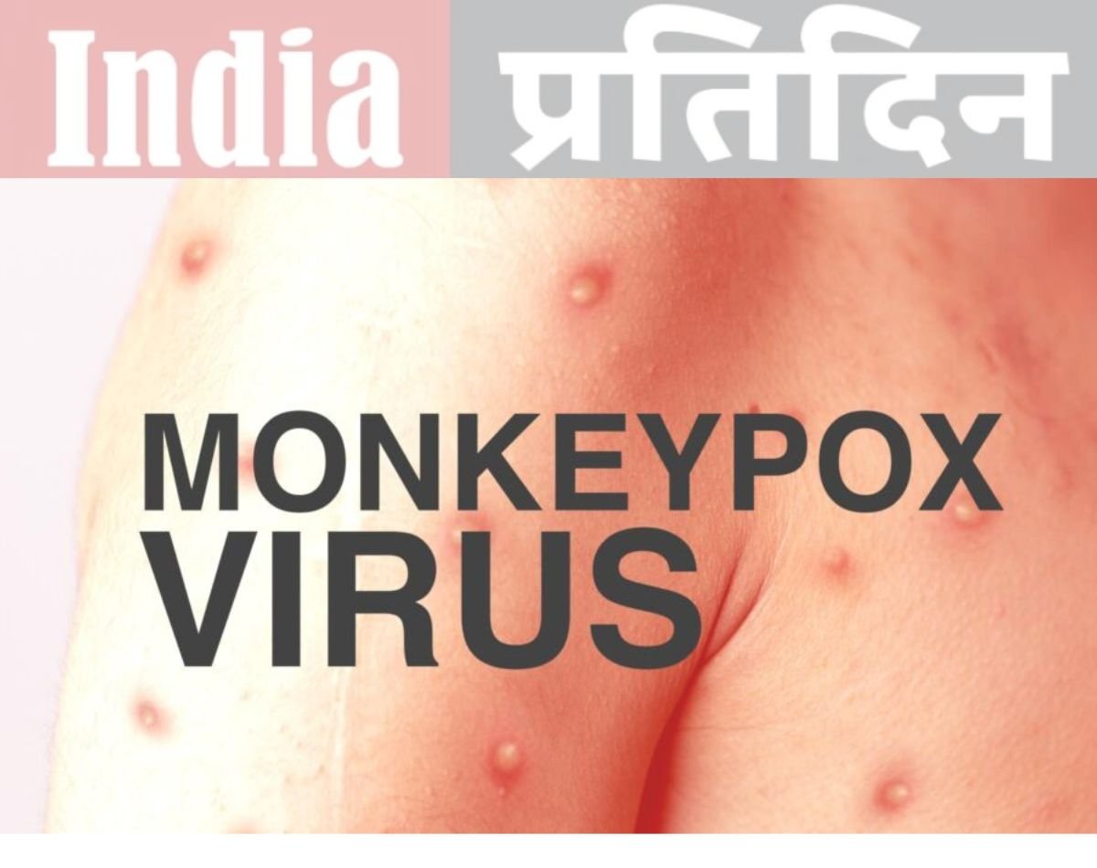 Monkeypox